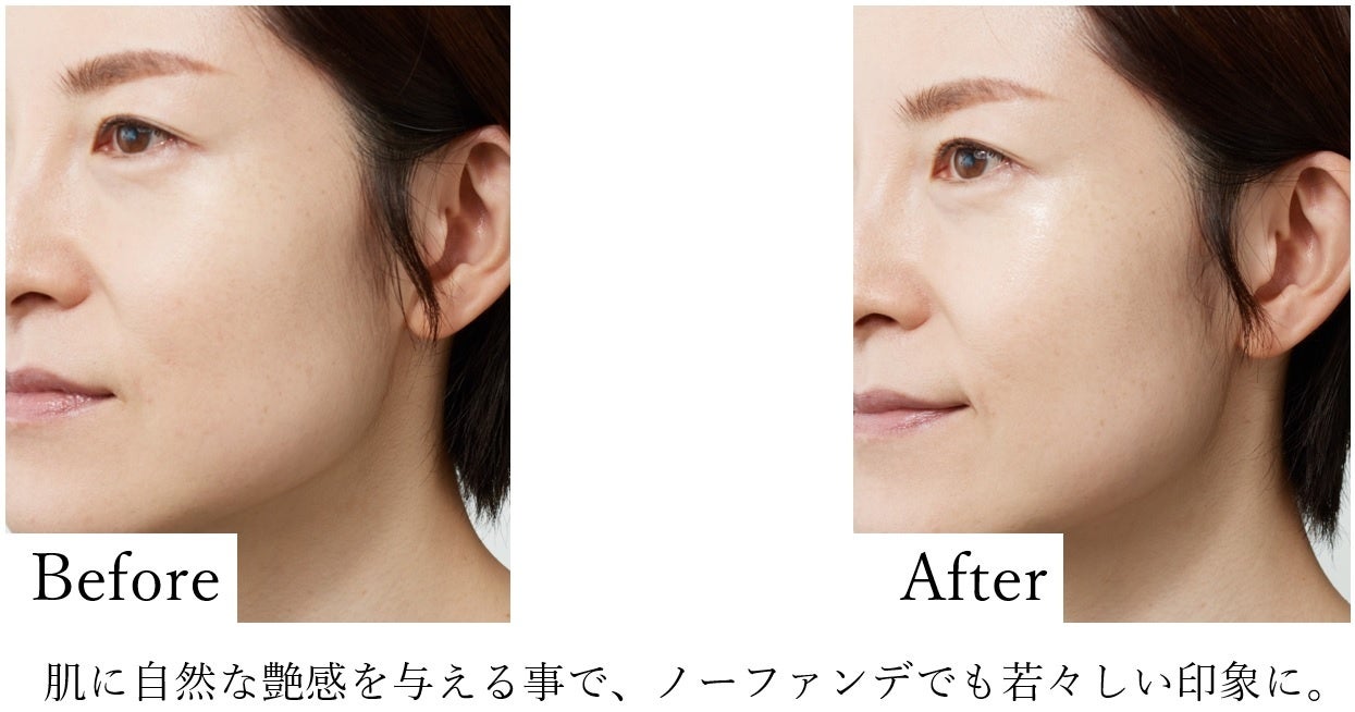 ミューノアージュ「シャイニングトリートメントセラム」2022年11月12日（土）“いい皮膚の日”に新発売のサブ画像3_「シャイニングトリートメントセラム」Before After