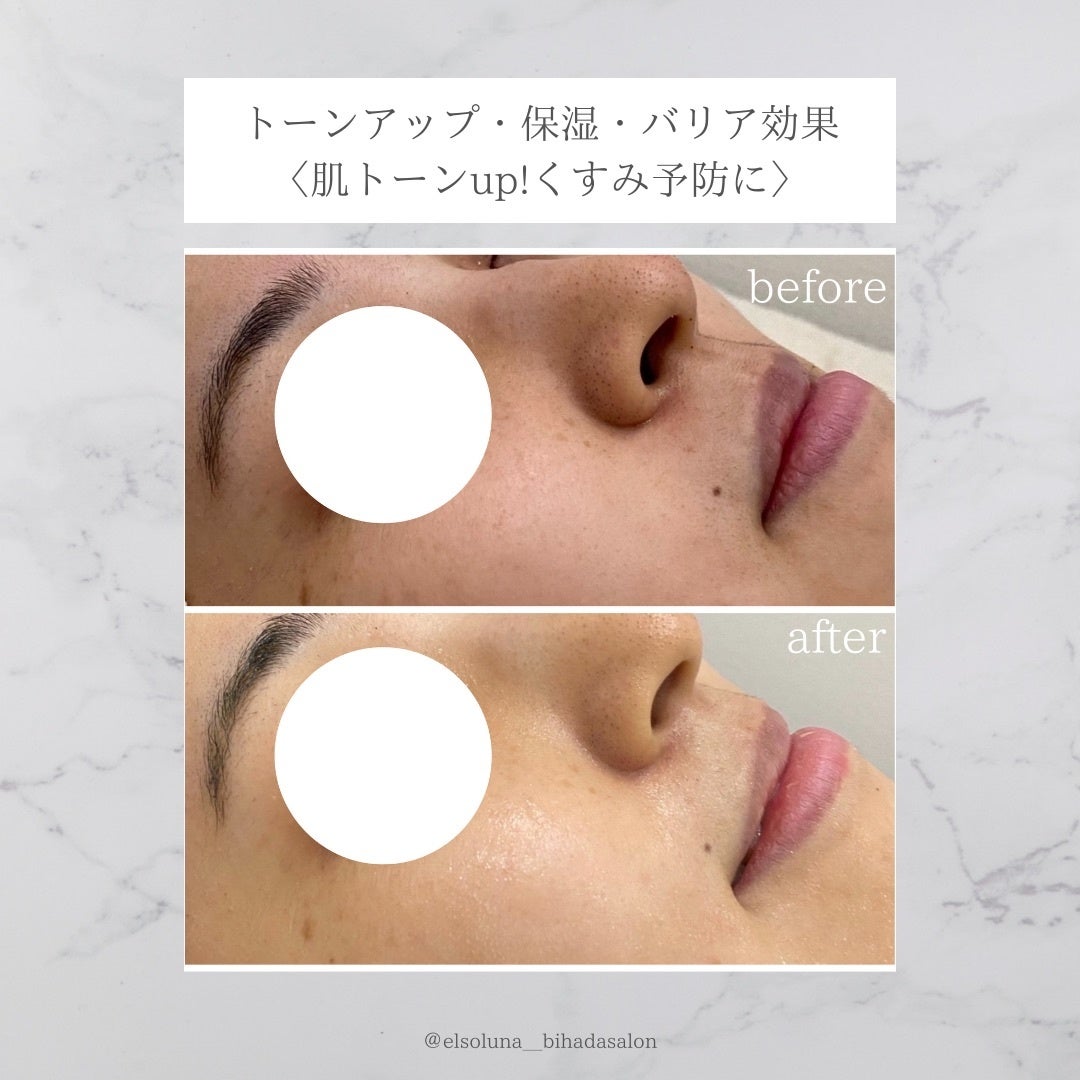 今、美容業界で話題の次世代ハーブピーリング！植物幹細胞の力で肌細胞を活性化させ、陶器のような美しい肌に！多くの著名人もお忍びで通う、話題のエステティックサロン『美肌サロンElsoluna南青山』のサブ画像7