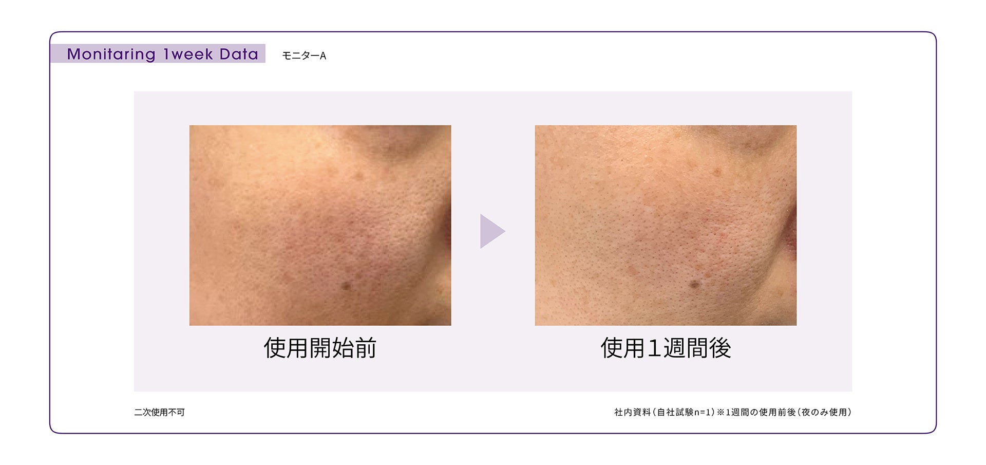 ＜Bb lab.（ビービーラボ）＞7日間の集中ケア。透明感のあるつややかな肌へ導く、特濃*1美容液「ＰＦＤ」＆「ＰＦＤパウダー（パウダー単体）」２月１７日（金）発売。のサブ画像5