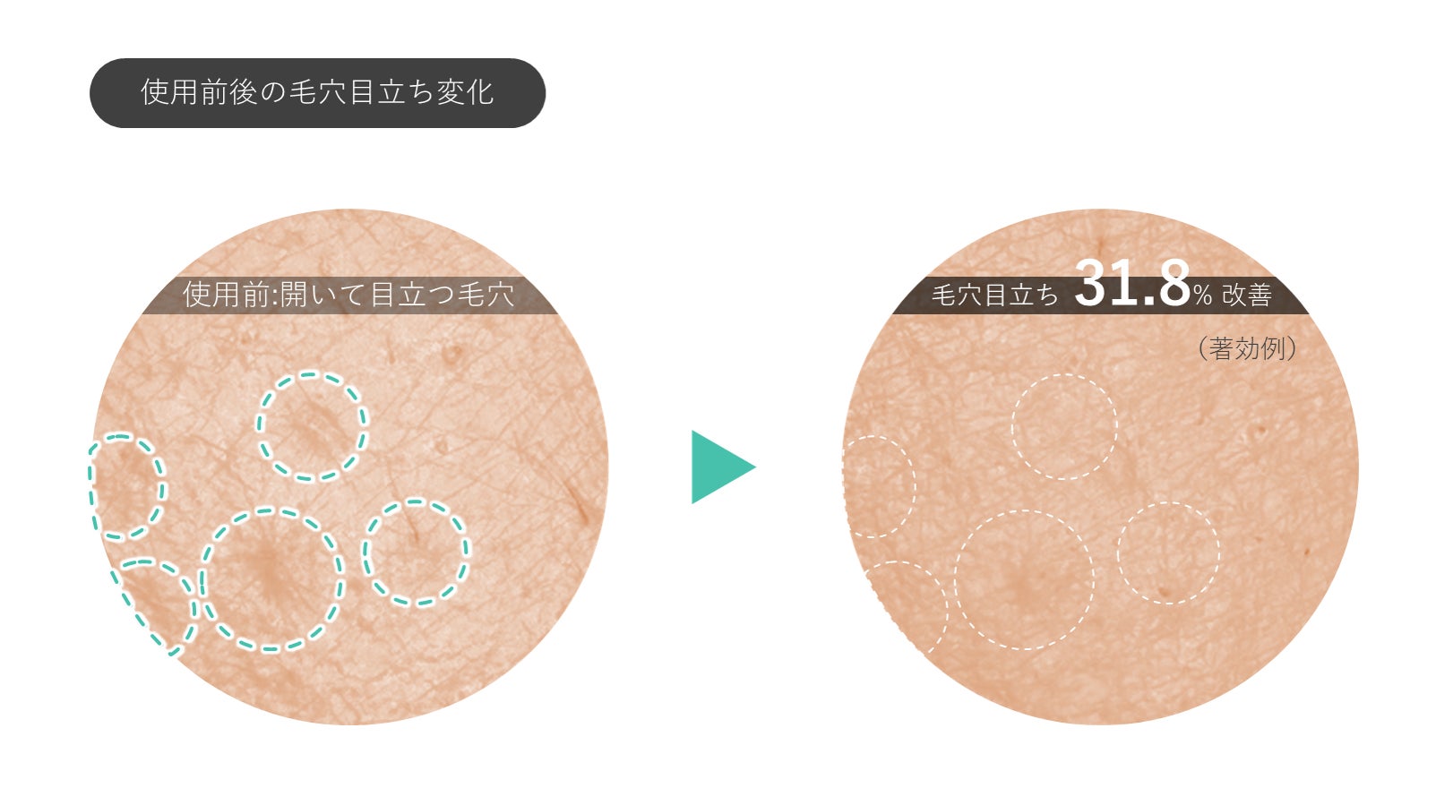 熱感応ポリマー×球状ポリマーによる「第2の皮膚形成技術」をサティス製薬が開発【新技術搭載スキンケア処方第2弾】のサブ画像4